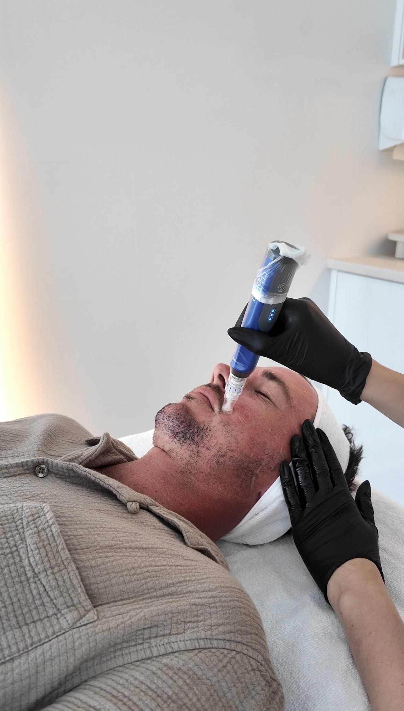 SkinPen microneedling treatment performed at Ashlee Jess Aesthetics